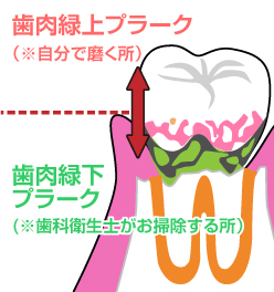 イメージ写真