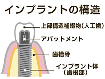 イメージ写真